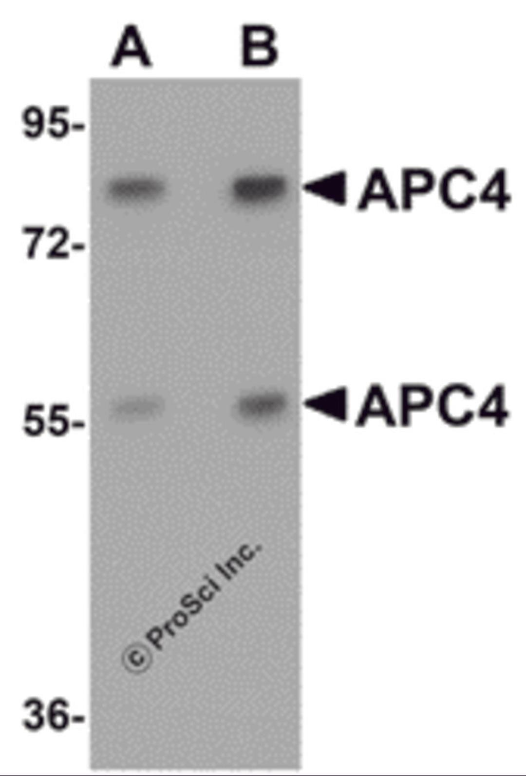 Western blot analysis of APC4 in mouse liver tissue lysate with APC4 antibody at (A) 1 and (B) 2 &#956;g/mL.