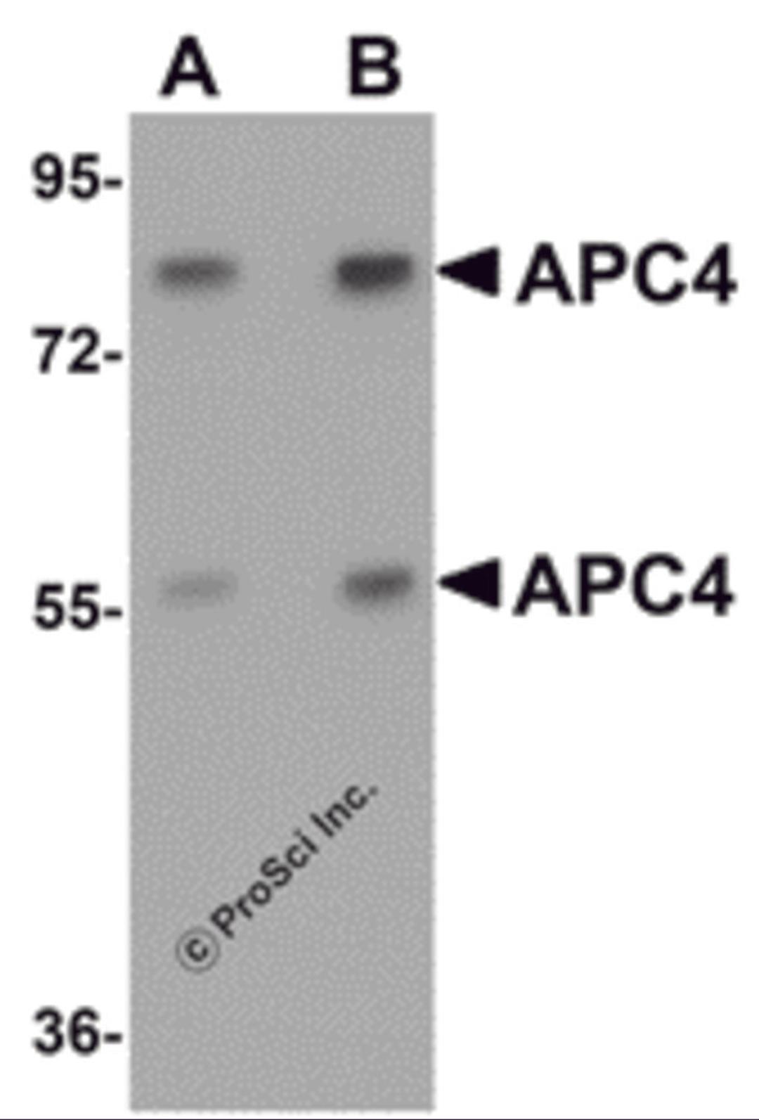Western blot analysis of APC4 in mouse liver tissue lysate with APC4 antibody at (A) 1 and (B) 2 μg/mL.