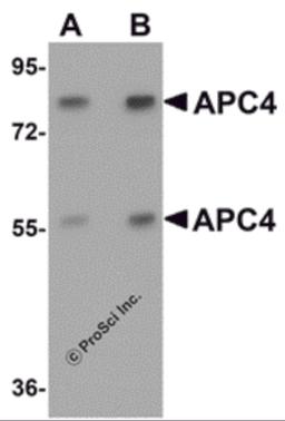 Western blot analysis of APC4 in mouse liver tissue lysate with APC4 antibody at (A) 1 and (B) 2 μg/mL.