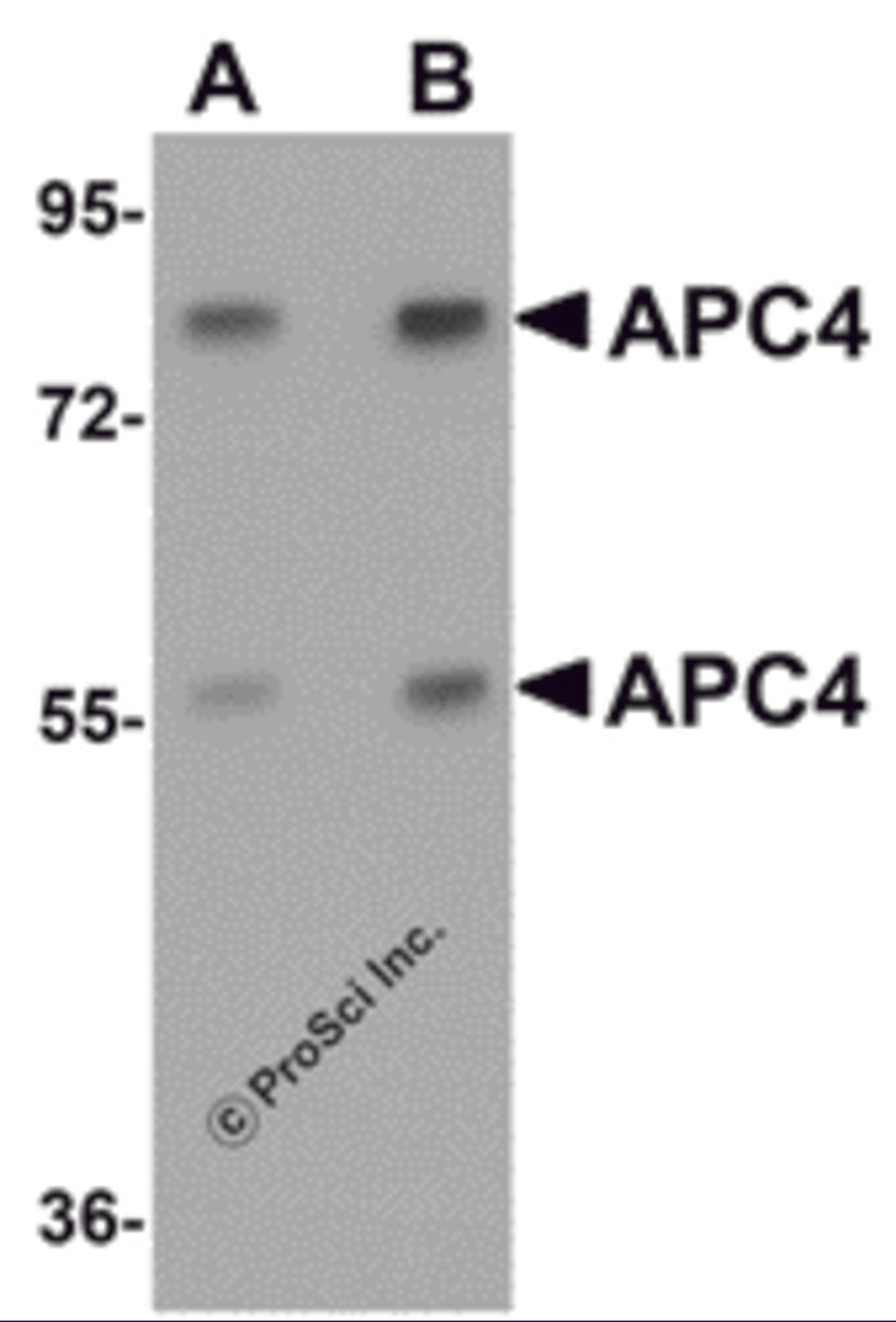 Western blot analysis of APC4 in mouse liver tissue lysate with APC4 antibody at (A) 1 and (B) 2 μg/mL.