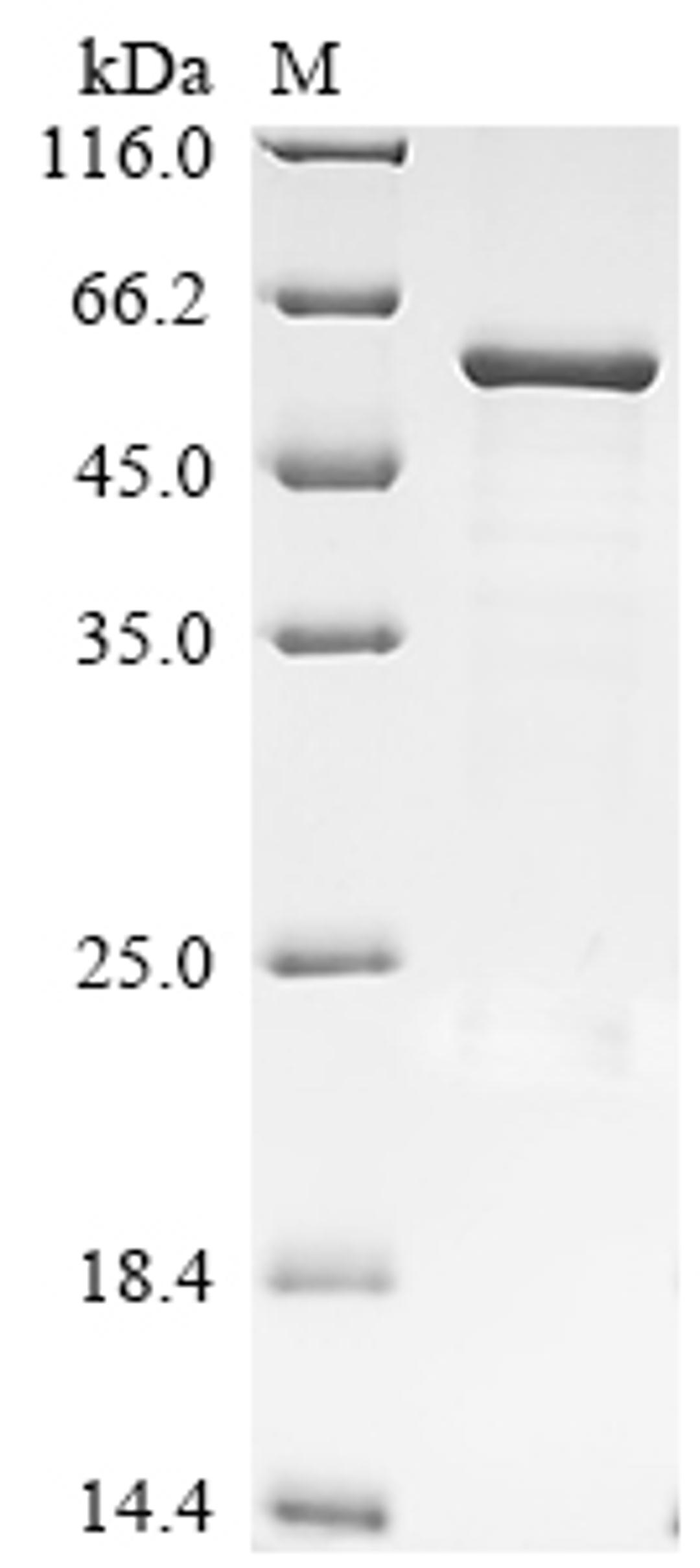 (Tris-Glycine gel) Discontinuous SDS-PAGE (reduced) with 5% enrichment gel and 15% separation gel.