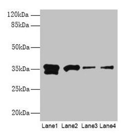 Western blot. All lanes: APEX1 antibody at 2µg/ml. Lane 1: Hela whole cell lysate. Lane 2: Mouse brain tissue. Lane 3: MCF-7 whole cell lysate. Lane 4: A431 whole cell lysate. Secondary. Goat polyclonal to rabbit IgG at 1/15000 dilution. Predicted band size: 36 kDa. Observed band size: 36 kDa