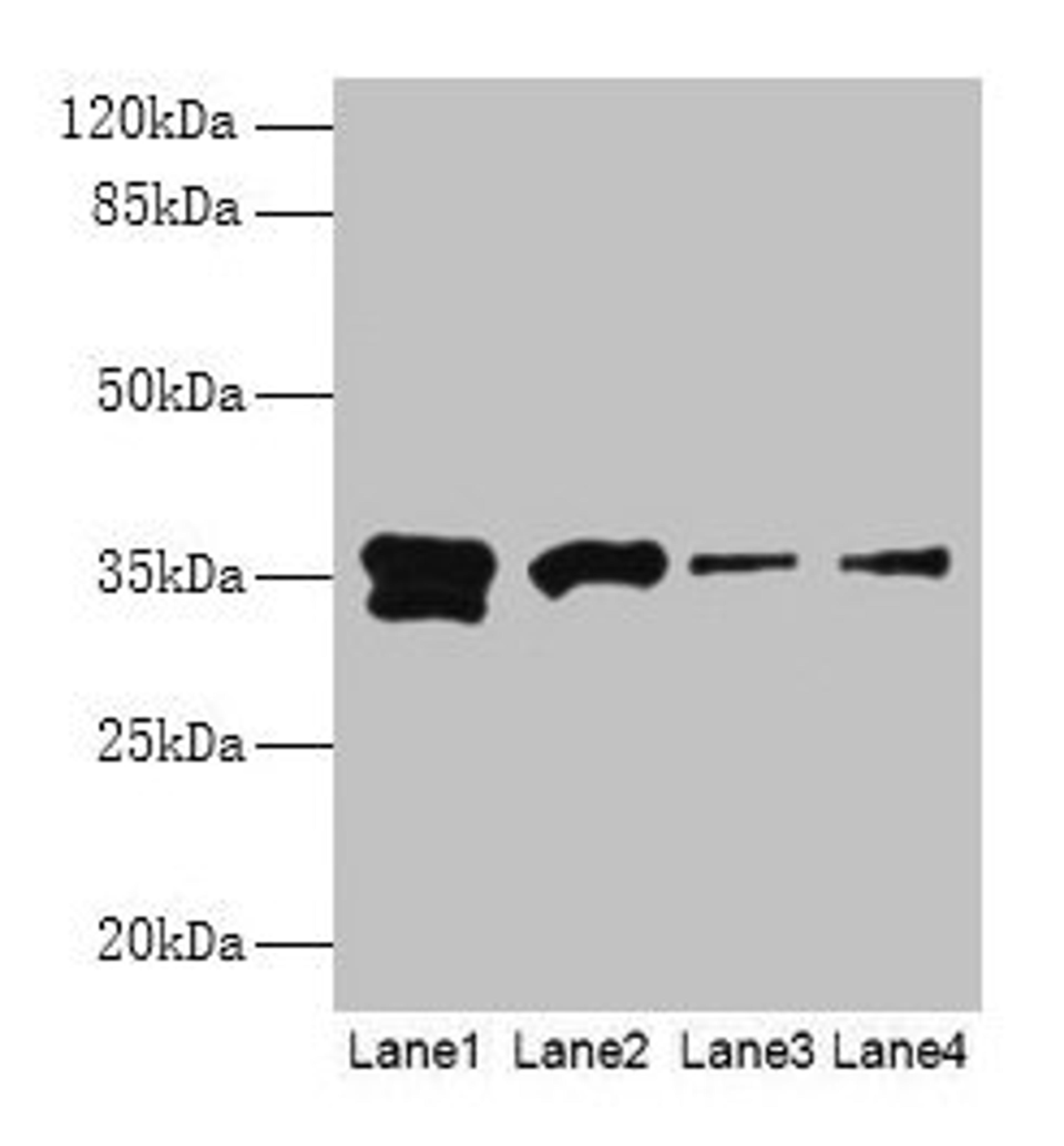 Western blot. All lanes: APEX1 antibody at 2µg/ml. Lane 1: Hela whole cell lysate. Lane 2: Mouse brain tissue. Lane 3: MCF-7 whole cell lysate. Lane 4: A431 whole cell lysate. Secondary. Goat polyclonal to rabbit IgG at 1/15000 dilution. Predicted band size: 36 kDa. Observed band size: 36 kDa
