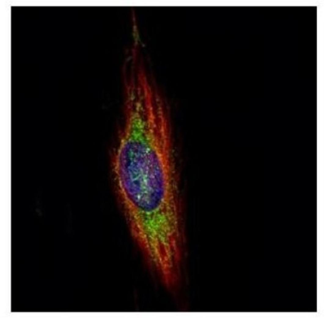 Immunocytochemistry/Immunofluorescence: WDR16 Antibody [NBP2-20889] - Confocal immunofluorescence analysis of methanol-fixed HeLa, using WDR16 antibody (Green) at 1:500 dilution. Alpha-tubulin filaments are labeled with Alpha-tubulin antibody (Red) at 1:2000.