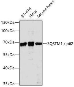 Western blot - SQSTM1 antibody (A11250)