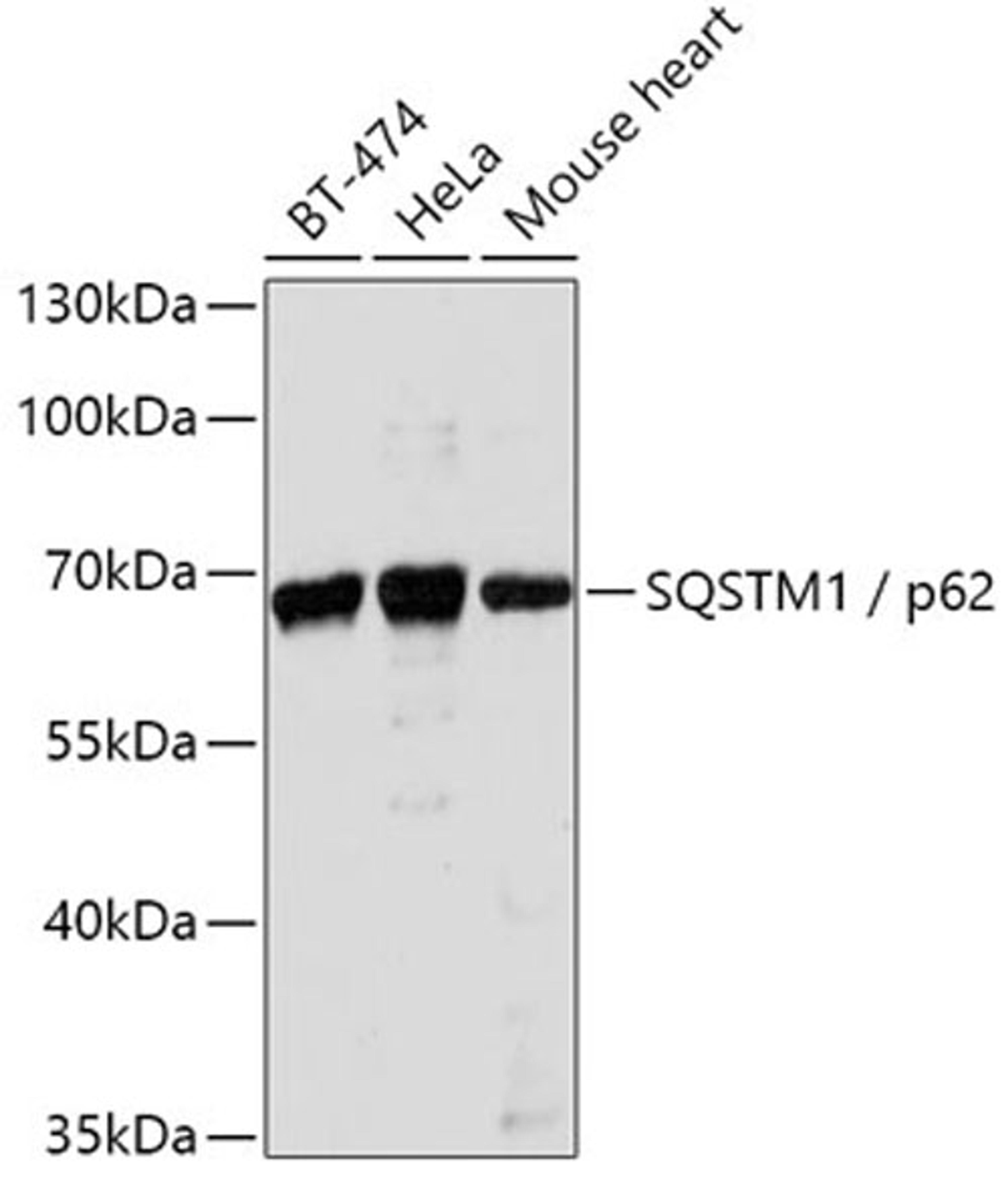 Western blot - SQSTM1 antibody (A11250)