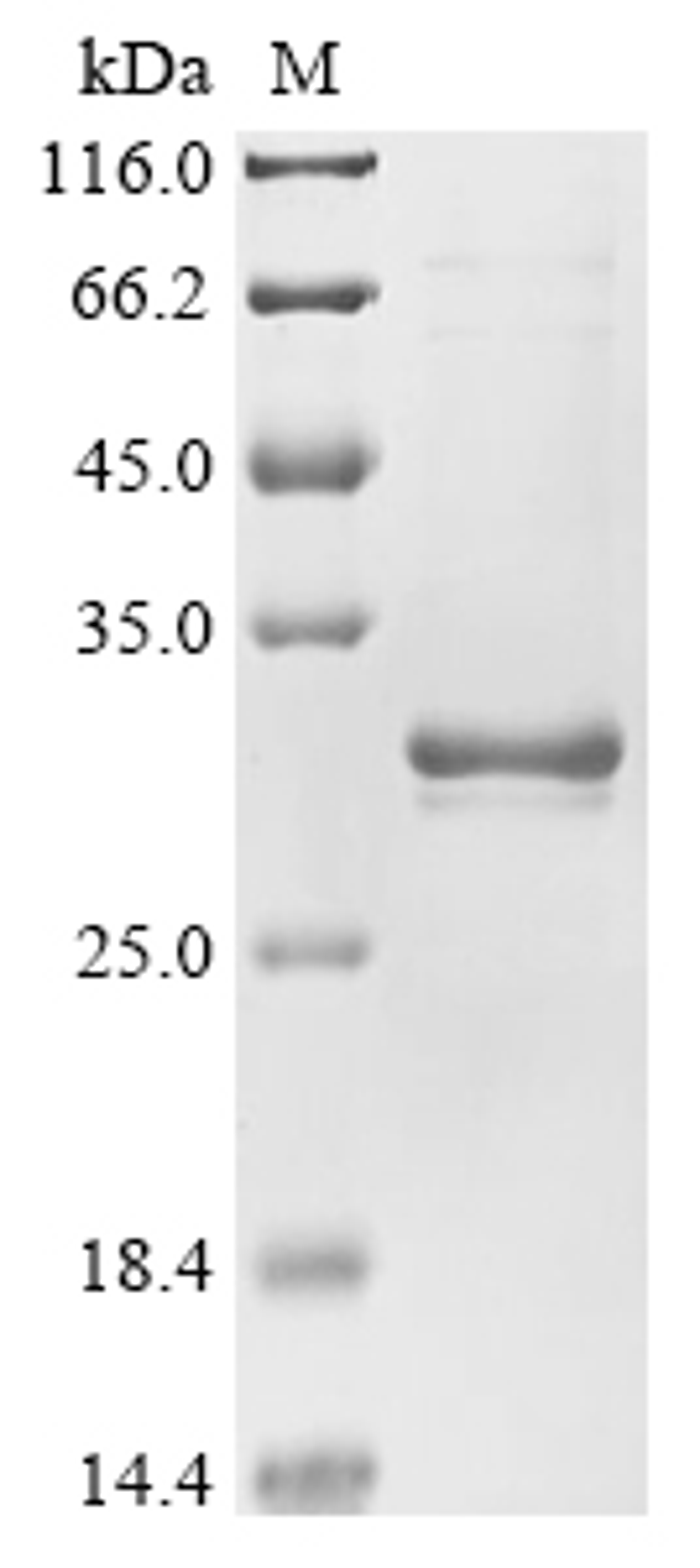 (Tris-Glycine gel) Discontinuous SDS-PAGE (reduced) with 5% enrichment gel and 15% separation gel.