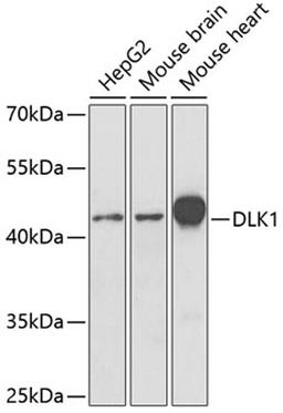 Western blot - DLK1 antibody (A6578)