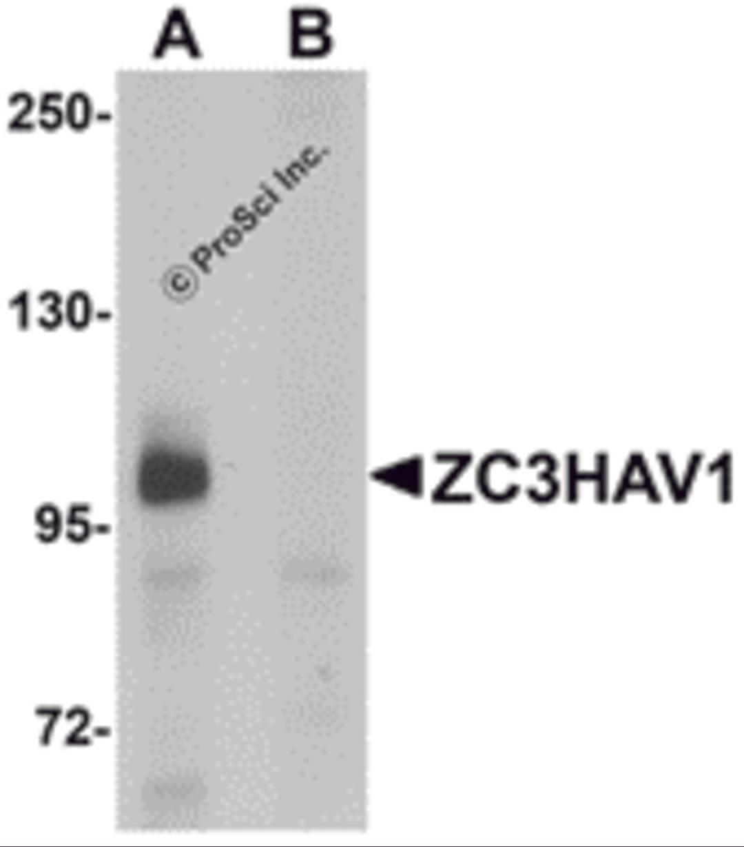 Western blot analysis of ZC3HAV1 in HeLa cell lysate with ZC3HAV1 antibody at 1μg/mL in (A) the absence and (B) the presence of blocking peptide.