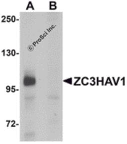 Western blot analysis of ZC3HAV1 in HeLa cell lysate with ZC3HAV1 antibody at 1μg/mL in (A) the absence and (B) the presence of blocking peptide.