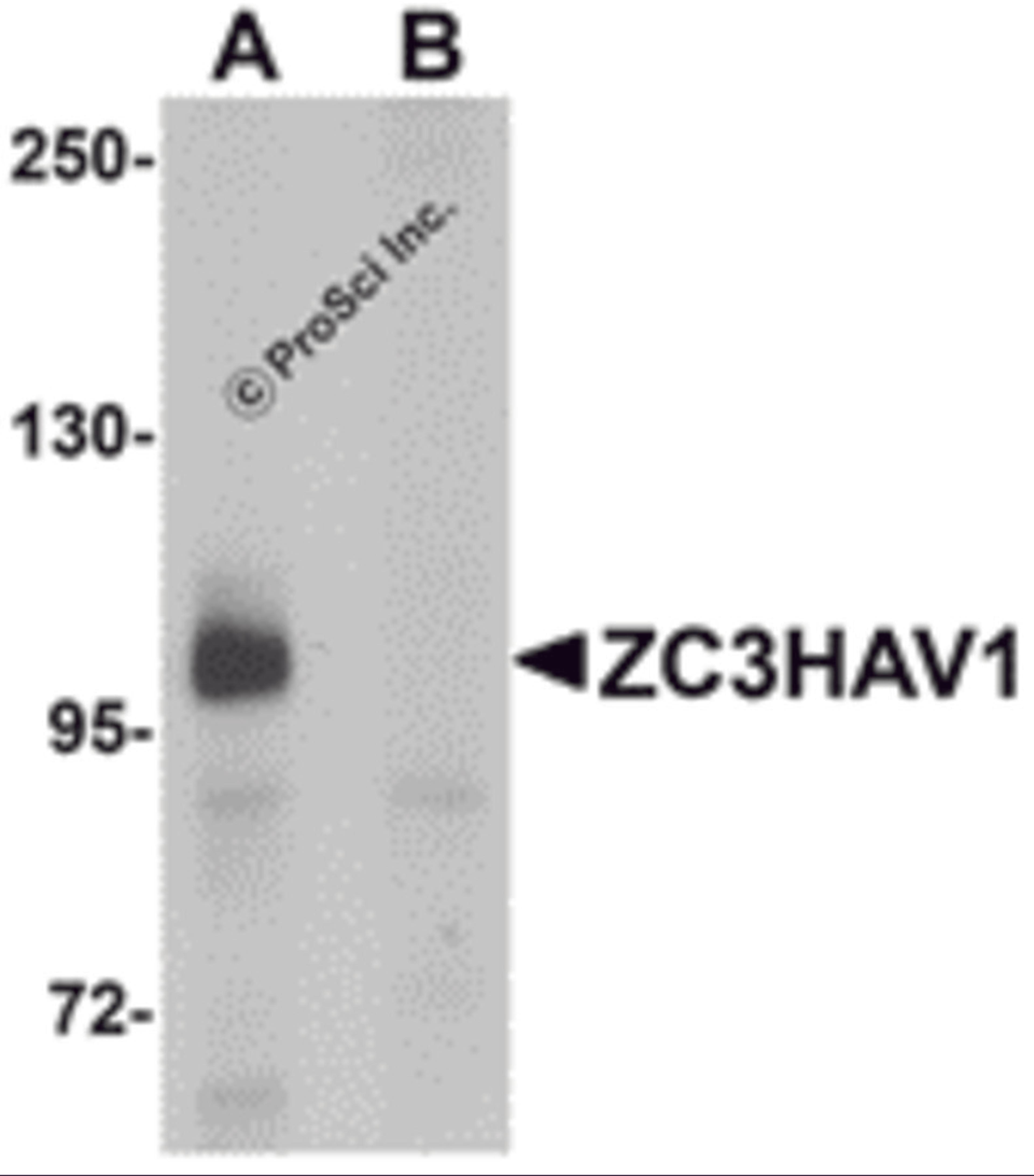 Western blot analysis of ZC3HAV1 in HeLa cell lysate with ZC3HAV1 antibody at 1μg/mL in (A) the absence and (B) the presence of blocking peptide.