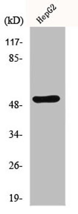 Western Blot analysis of HepG2 cells using MMP-1 Polyclonal Antibody