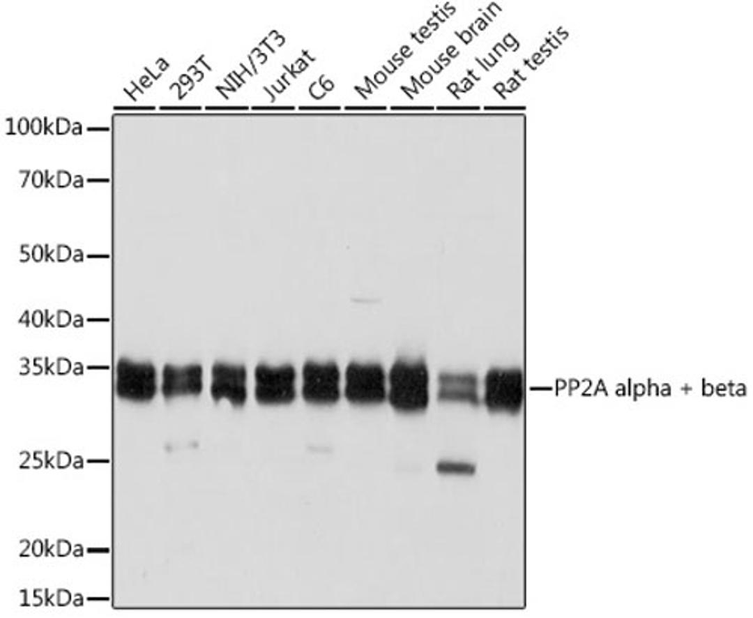 Western blot - PP2A alpha + beta Rabbit mAb (A6175)