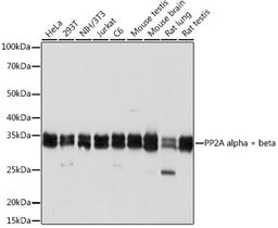 Western blot - PP2A alpha + beta Rabbit mAb (A6175)