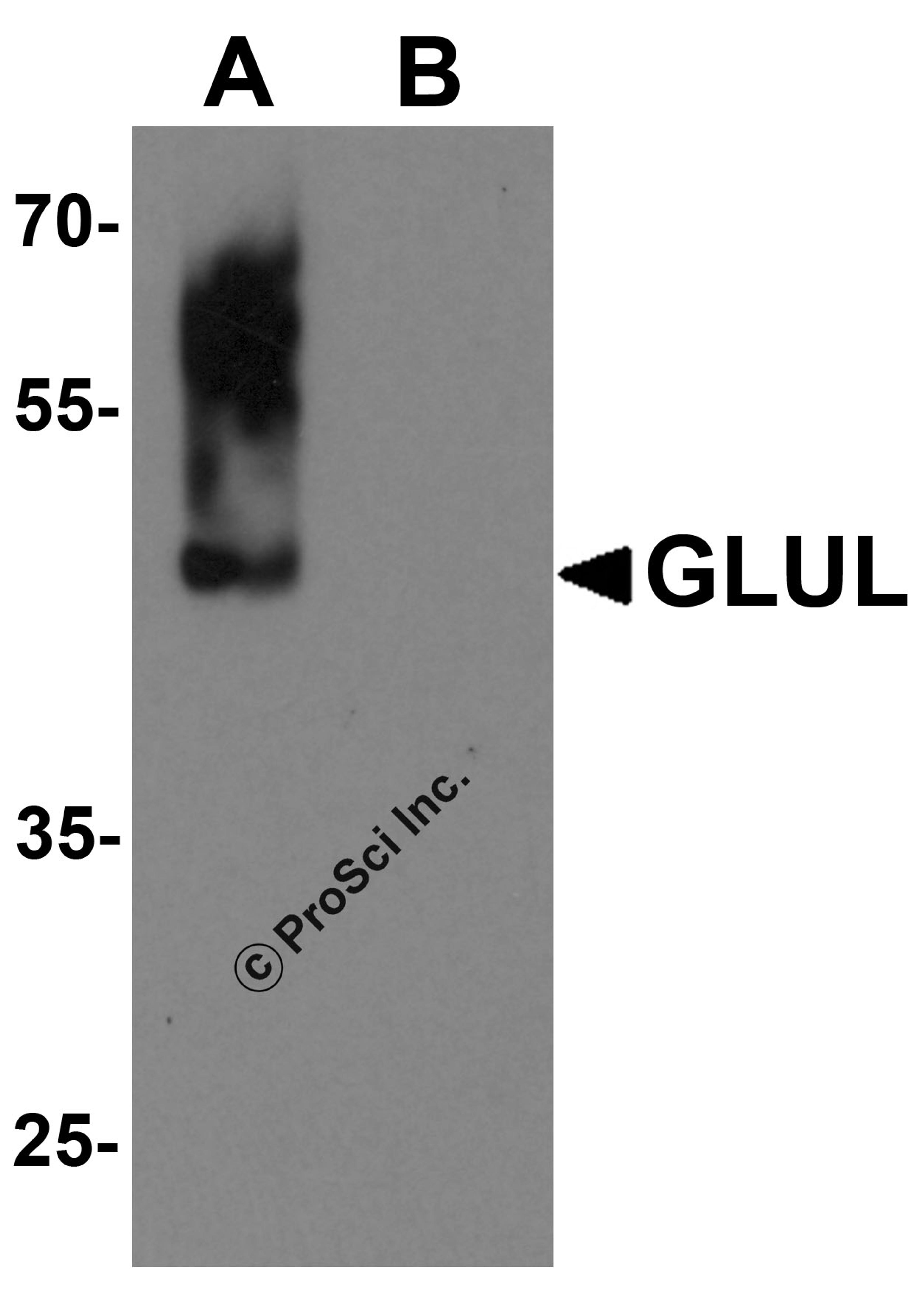 Western blot analysis of GLUL in human brain tissue lysate with GLUL antibody at 0.5 μg/mL in (A) the absence and (B) the presence of blocking buffer.