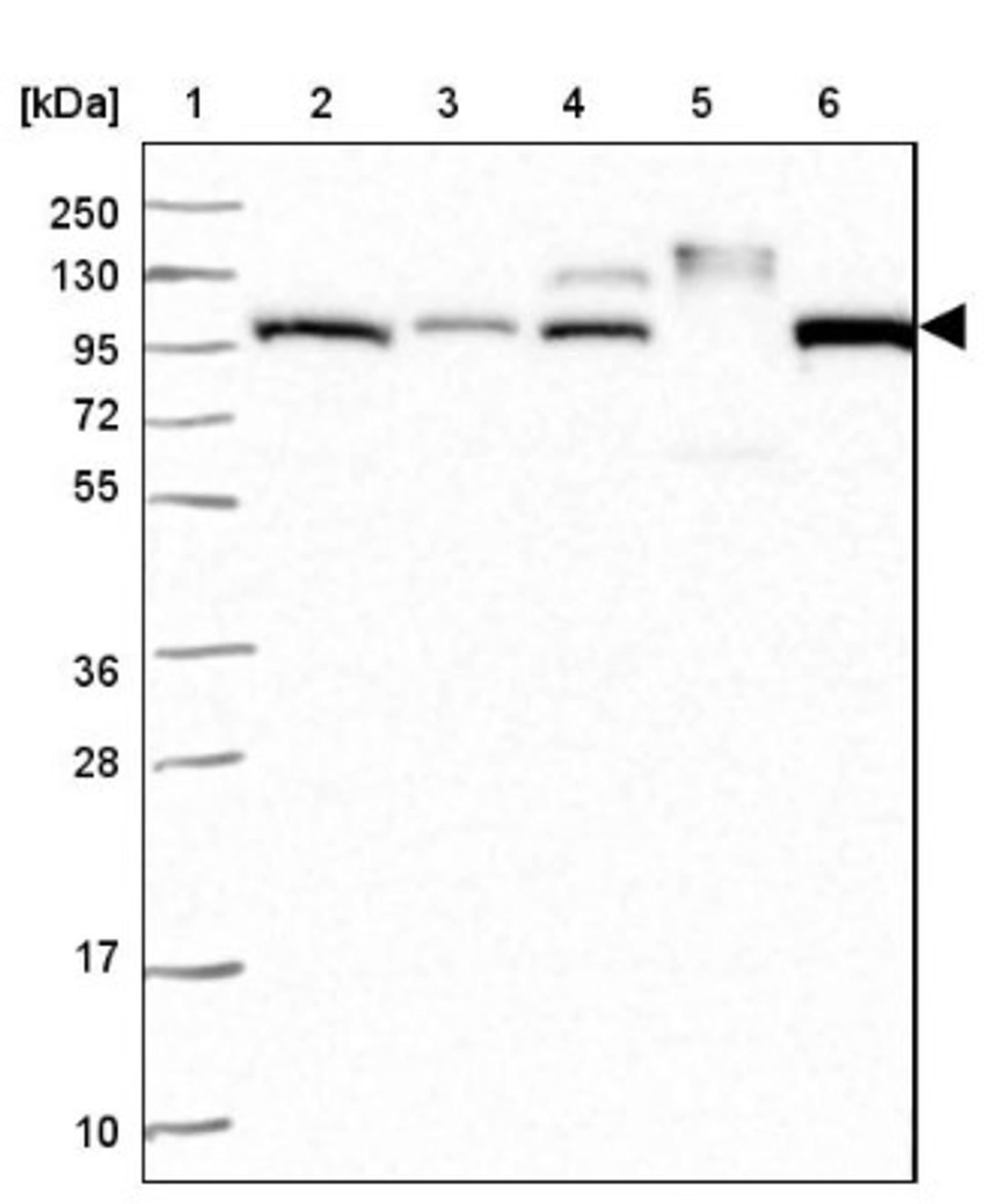 Western Blot: Apolipoprotein B/ApoB Antibody [NBP2-38608] - Lane 1: Marker [kDa] 250, 130, 95, 72, 55, 36, 28, 17, 10<br/>Lane 2: RT-4<br/>Lane 3: U-251 MG<br/>Lane 4: Human Plasma<br/>Lane 5: Liver<br/>Lane 6: Tonsil