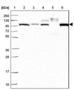 Western Blot: Apolipoprotein B/ApoB Antibody [NBP2-38608] - Lane 1: Marker [kDa] 250, 130, 95, 72, 55, 36, 28, 17, 10<br/>Lane 2: RT-4<br/>Lane 3: U-251 MG<br/>Lane 4: Human Plasma<br/>Lane 5: Liver<br/>Lane 6: Tonsil