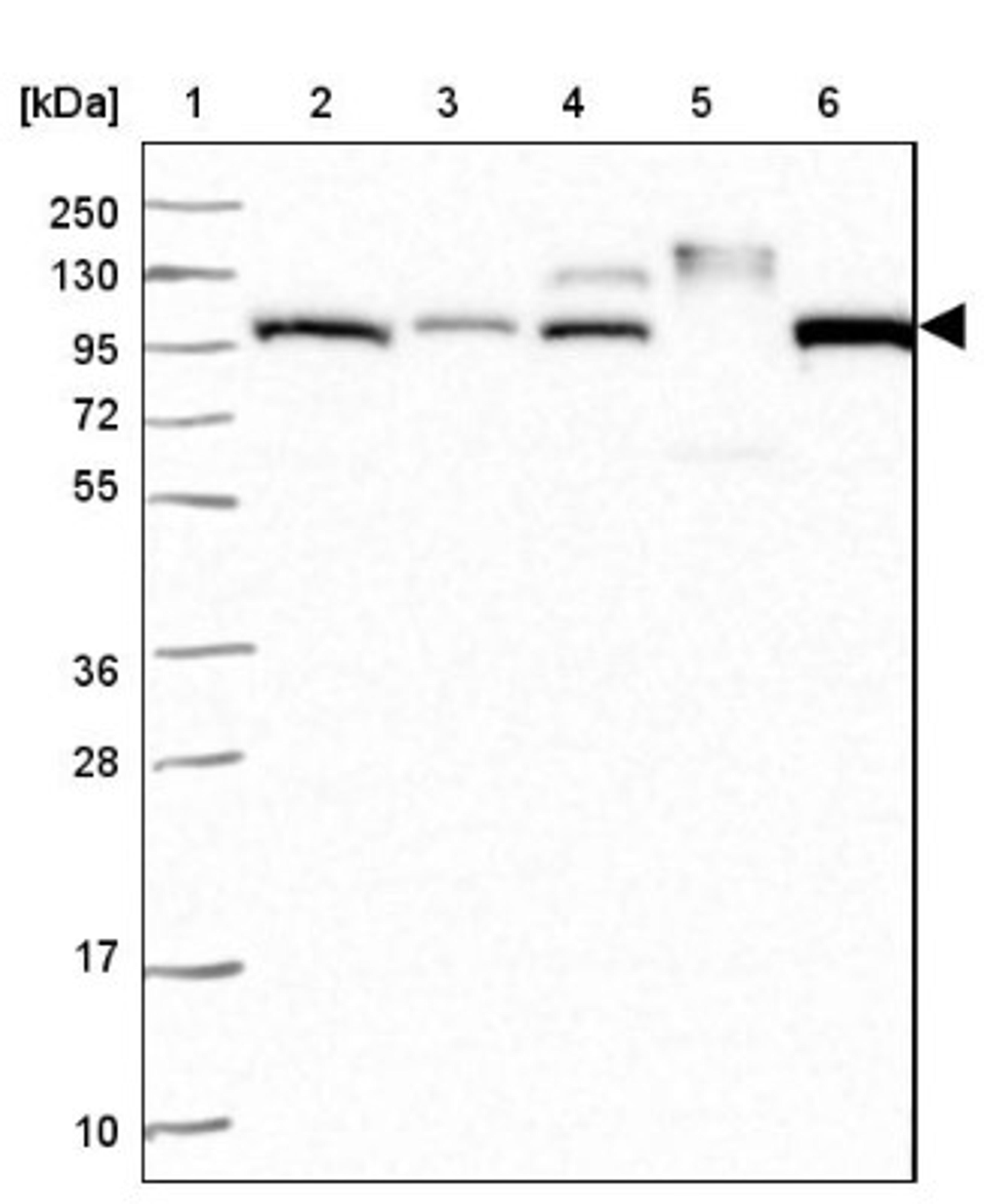 Western Blot: Apolipoprotein B/ApoB Antibody [NBP2-38608] - Lane 1: Marker [kDa] 250, 130, 95, 72, 55, 36, 28, 17, 10<br/>Lane 2: RT-4<br/>Lane 3: U-251 MG<br/>Lane 4: Human Plasma<br/>Lane 5: Liver<br/>Lane 6: Tonsil