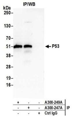 Detection of human P53 by western blot of immunoprecipitates.