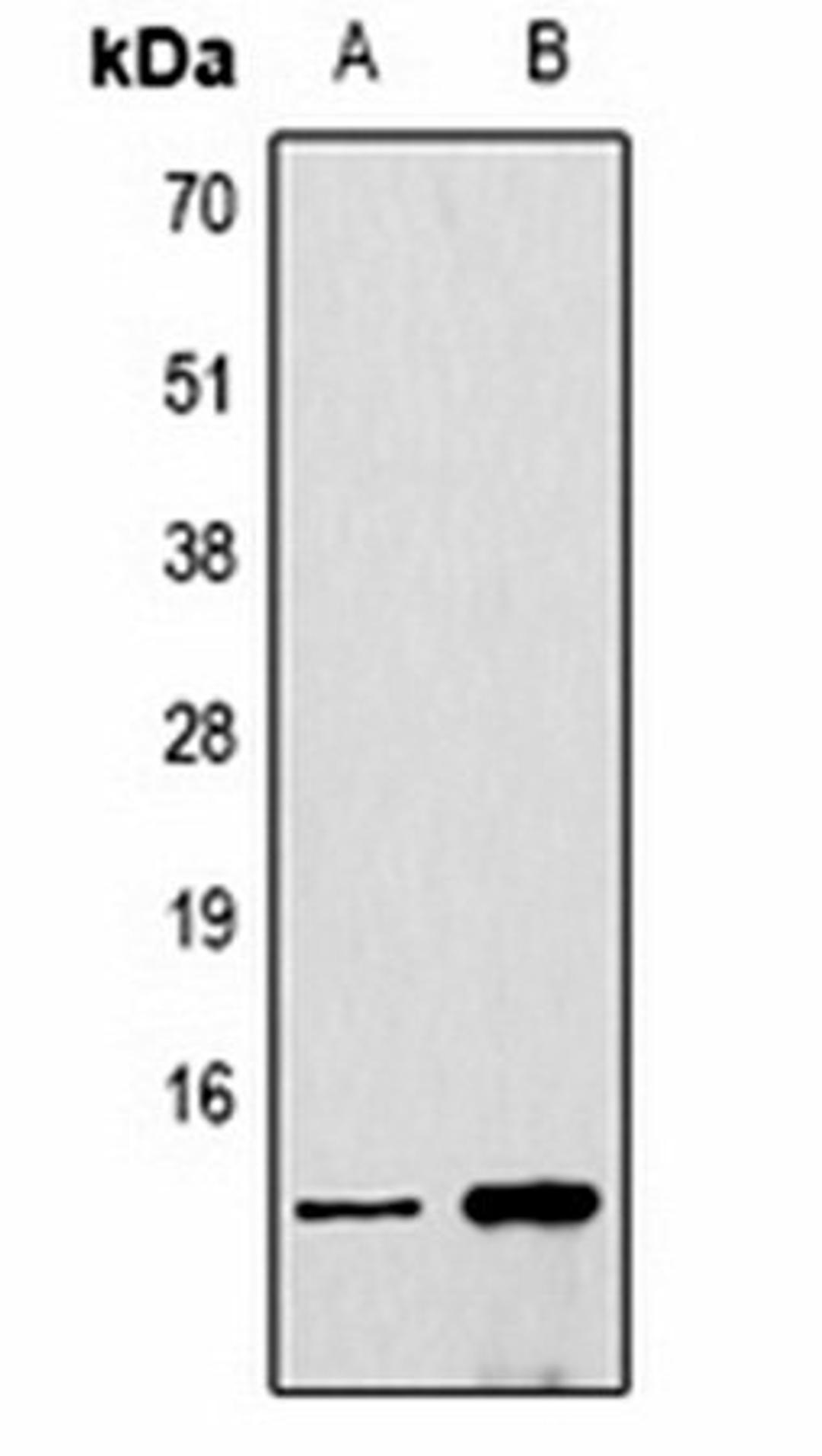 Western blot analysis of  Hela (Lane1), NIH3T3 (Lane2) whole cell lysates using Histone H4 (DiMethyl K20) antibody