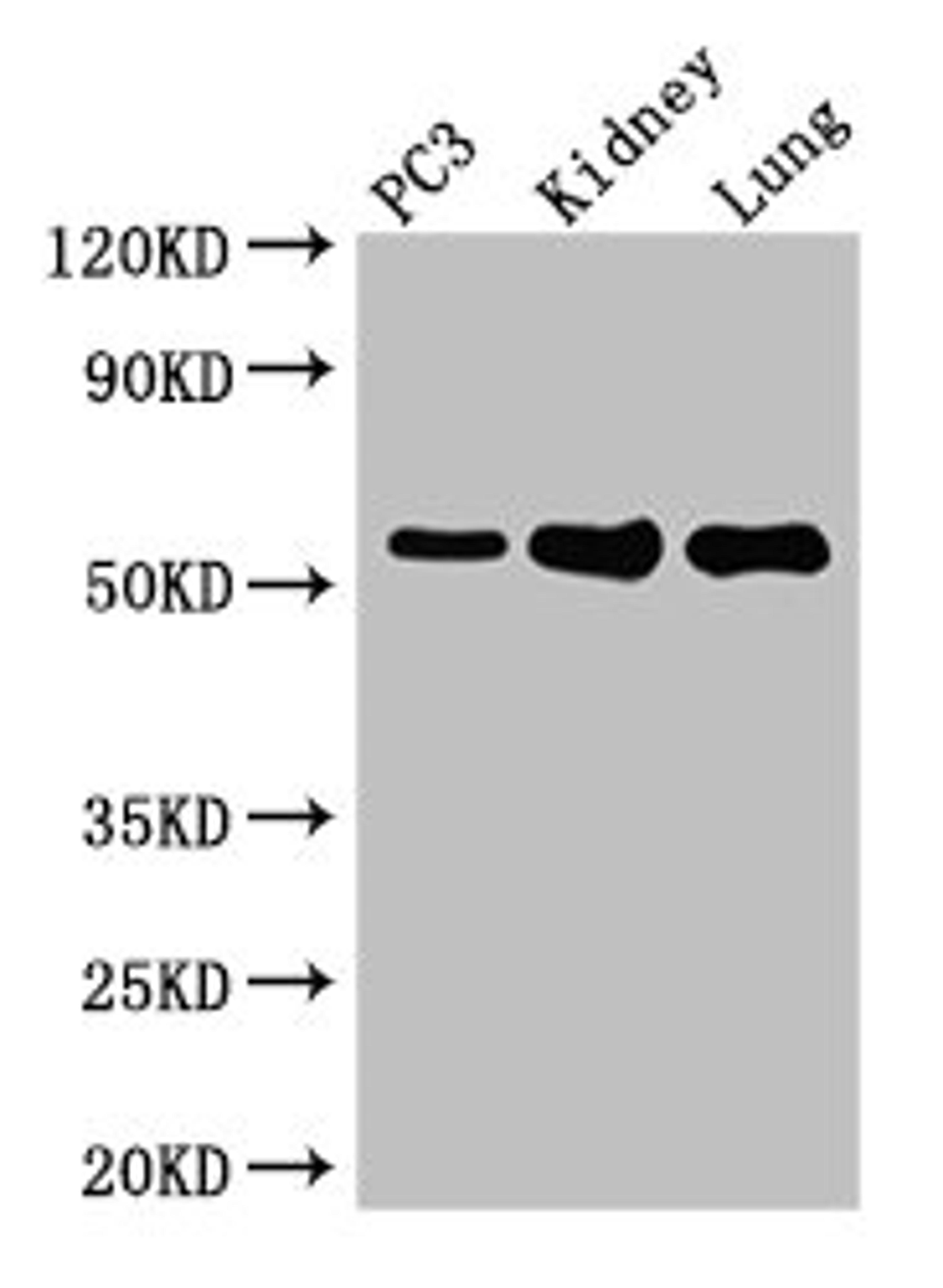 Western Blot. Positive WB detected in: PC-3 whole cell lysate, Mouse kidney tissue, Mouse lung tissue. All lanes: MMP13 antibody at 2µg/ml. Secondary. Goat polyclonal to rabbit IgG at 1/50000 dilution. Predicted band size: 54 kDa. Observed band size: 54 kDa
