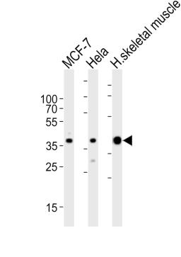 Western blot analysis of lysates from MCF-7, Hela cell line and human skeletal muscle tissue lysate (from left to right), using ALDOA Antibody at 1:1000 at each lane.