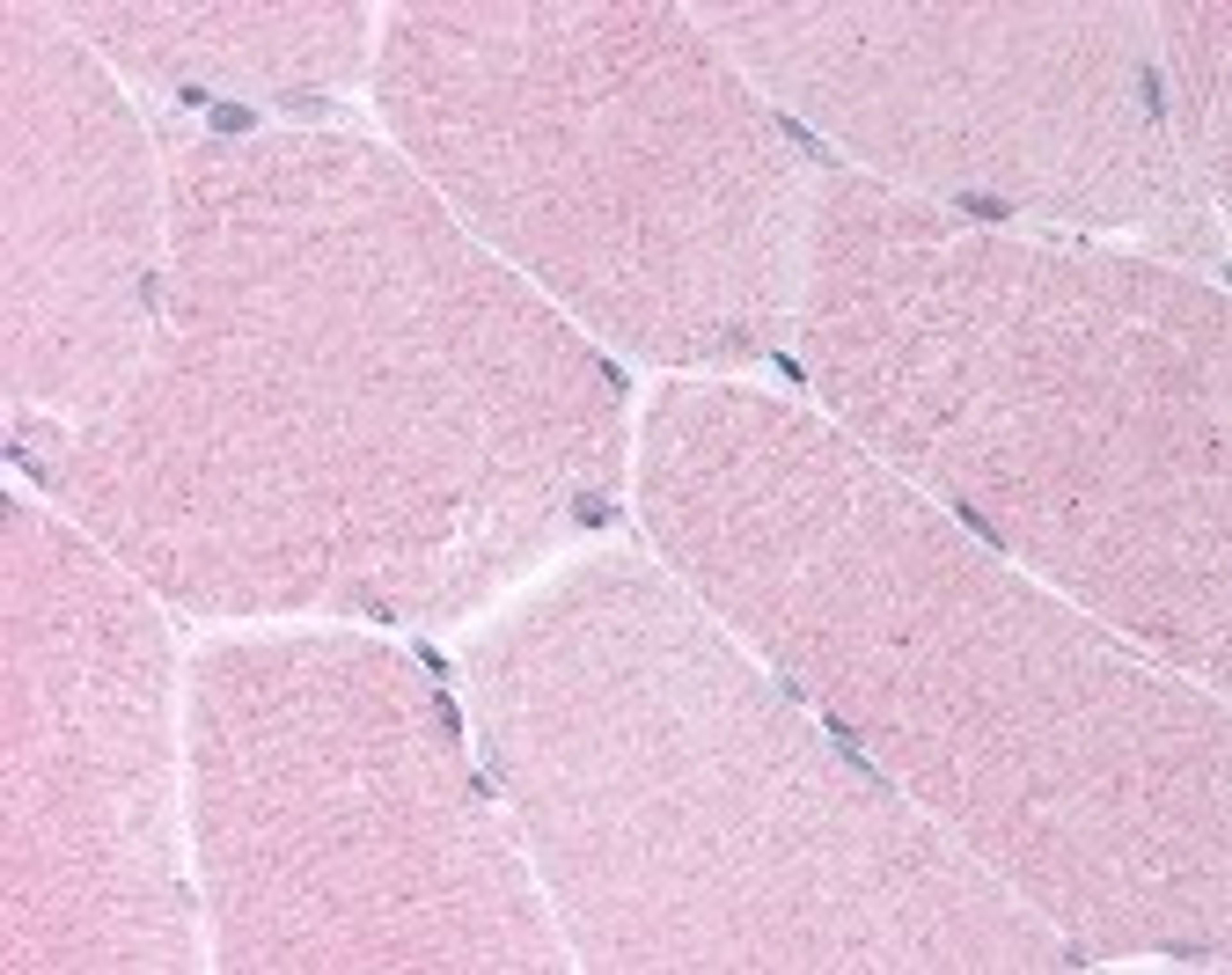 Immunohistochemistry staining of BARD1 in skeletal muscle tissue using BARD1 Antibody.