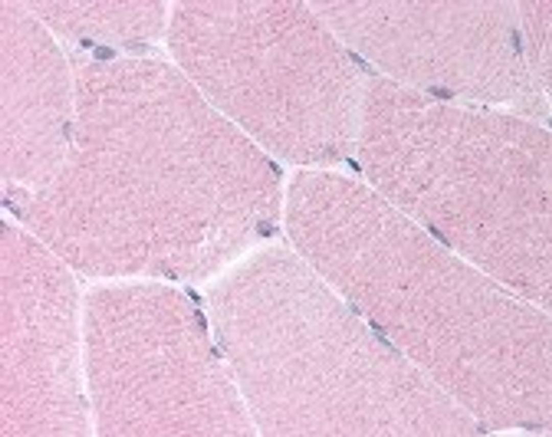 Immunohistochemistry staining of BARD1 in skeletal muscle tissue using BARD1 Antibody.