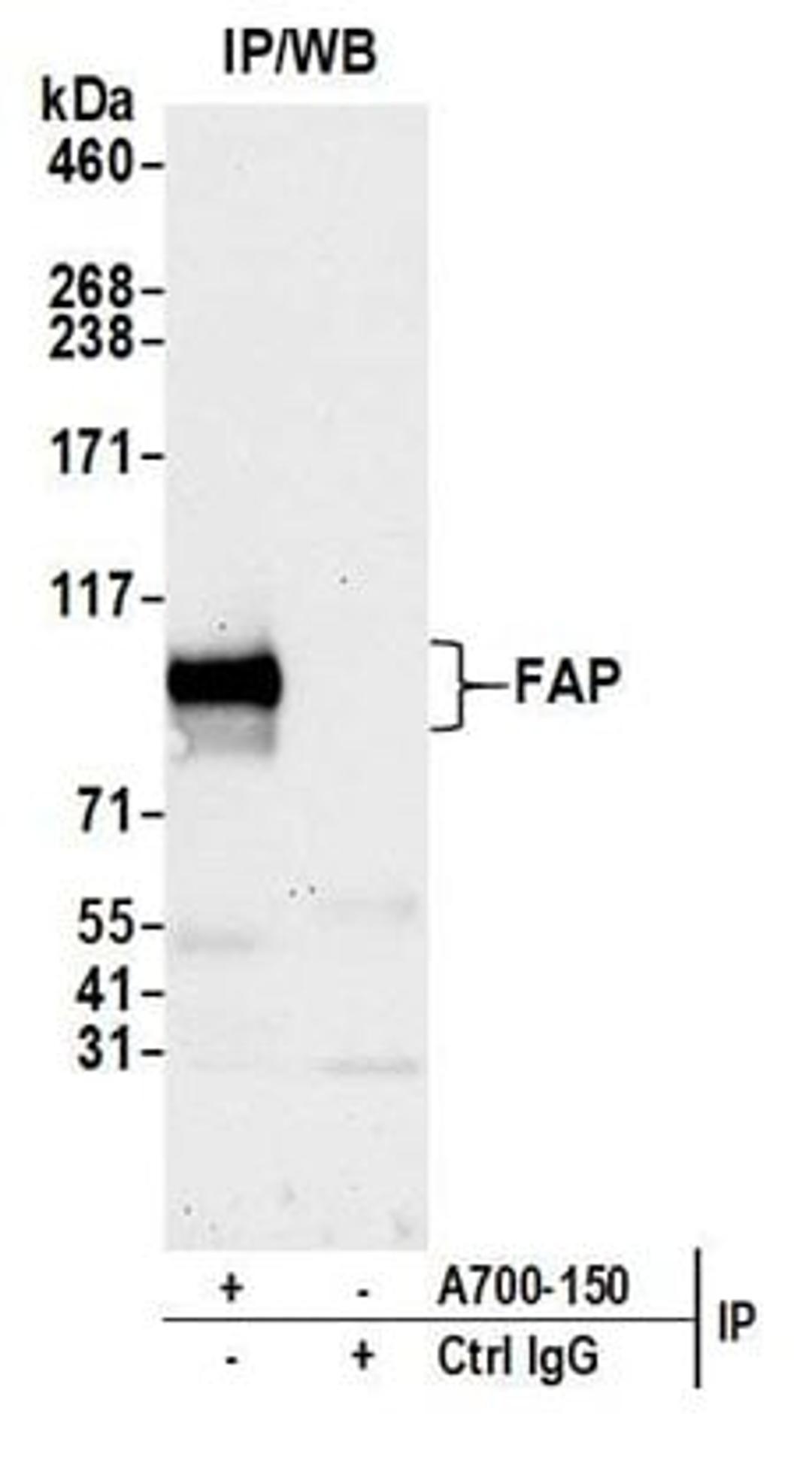 Detection of human Fibroblast Activation Protein alpha/FAP by western blot of immunoprecipitates.