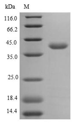 (Tris-Glycine gel) Discontinuous SDS-PAGE (reduced) with 5% enrichment gel and 15% separation gel.