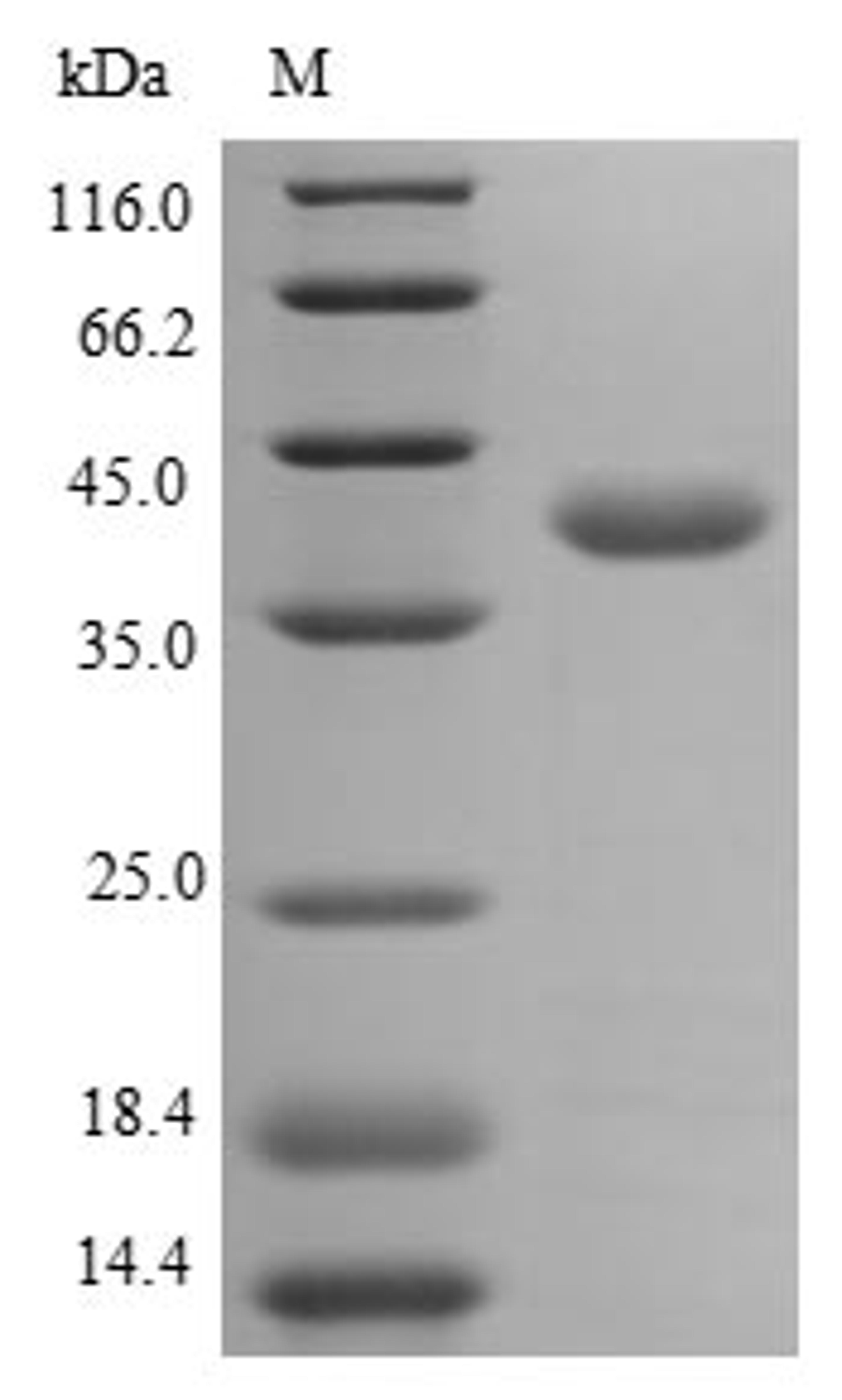 (Tris-Glycine gel) Discontinuous SDS-PAGE (reduced) with 5% enrichment gel and 15% separation gel.