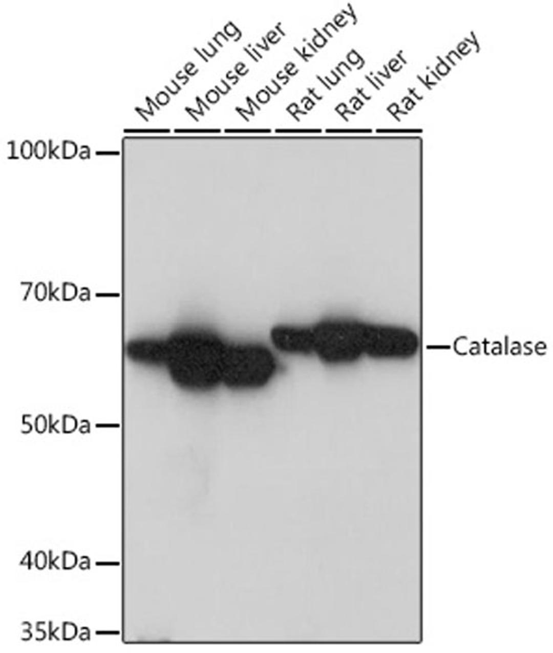 Western blot - Catalase Rabbit mAb (A11220)