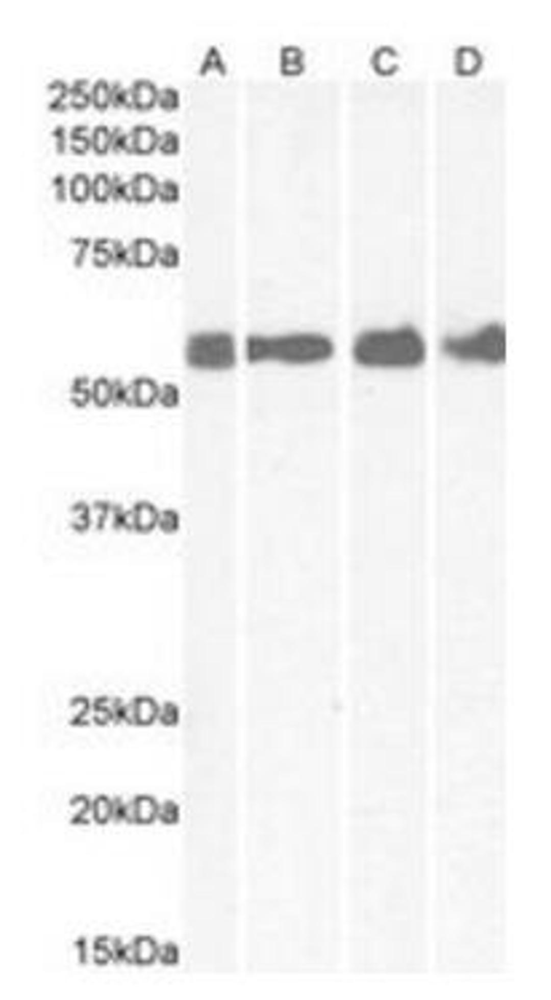 Western blot analysis of Human Colon (Lane 1), Cerebellum (Lane 2), Rat Brain (Lane 3) and Mouse spinal Cord (Lane 4) lysates using CRHR1 antibody