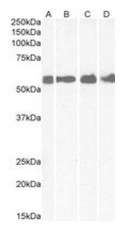 Western blot analysis of Human Colon (Lane 1), Cerebellum (Lane 2), Rat Brain (Lane 3) and Mouse spinal Cord (Lane 4) lysates using CRHR1 antibody