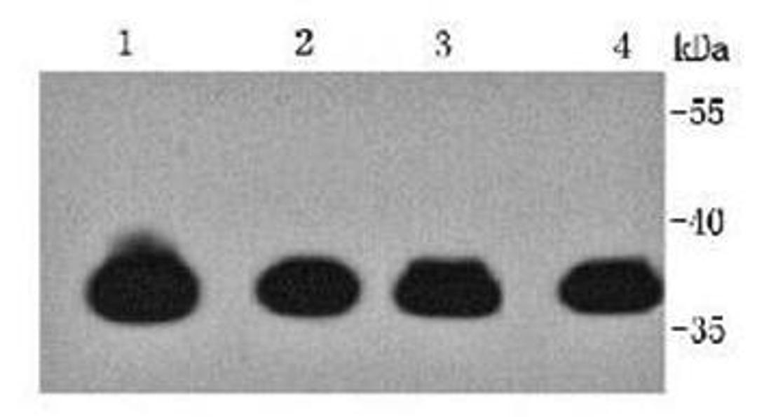 Western blot analysis of human heart(Lane 1) human muscle(Lane 2) Mouse heart(Lane 3) Rat mouse(Lane 4) using TTNNT2 antibody