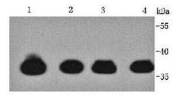 Western blot analysis of human heart(Lane 1) human muscle(Lane 2) Mouse heart(Lane 3) Rat mouse(Lane 4) using TTNNT2 antibody