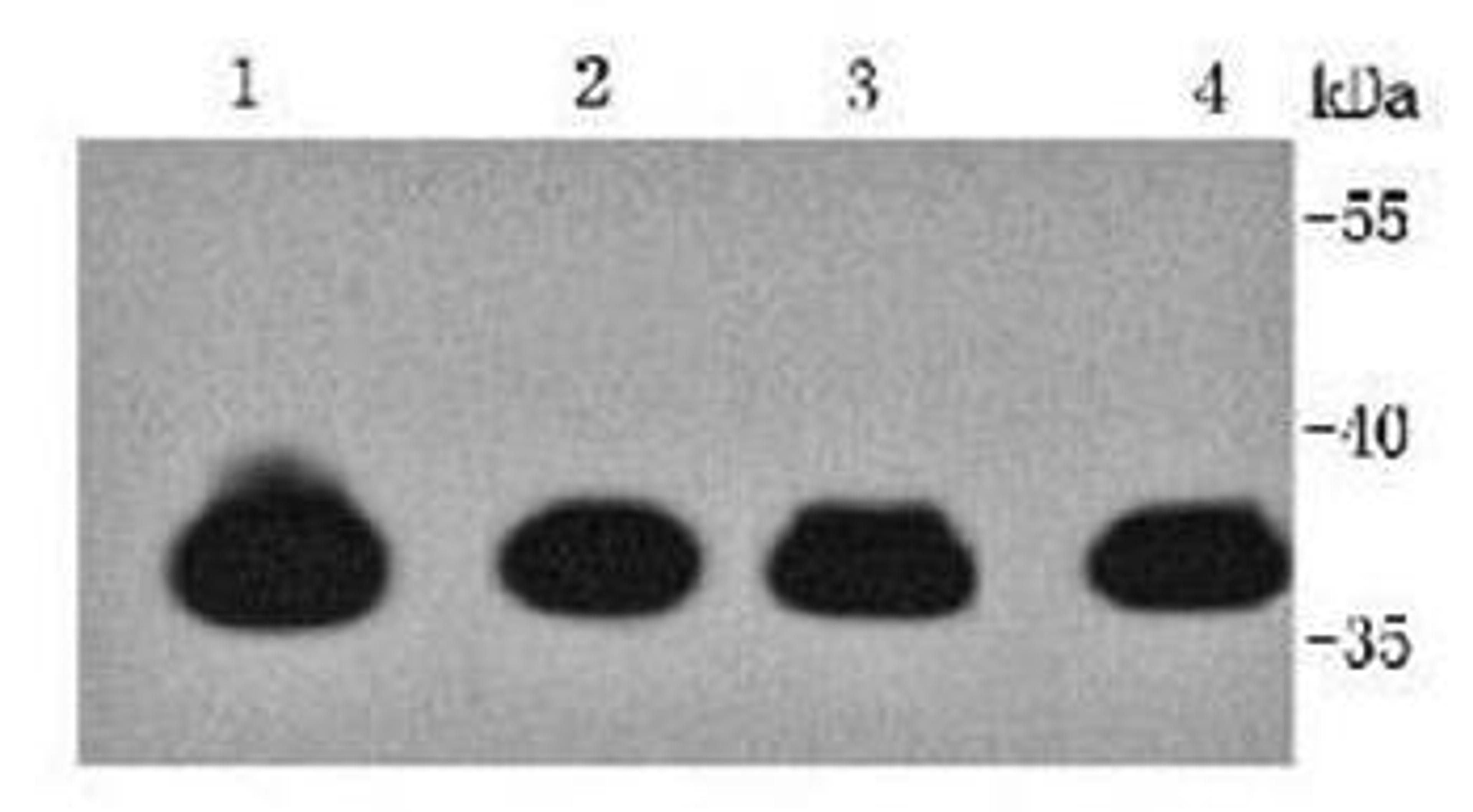 Western blot analysis of human heart(Lane 1) human muscle(Lane 2) Mouse heart(Lane 3) Rat mouse(Lane 4) using TTNNT2 antibody