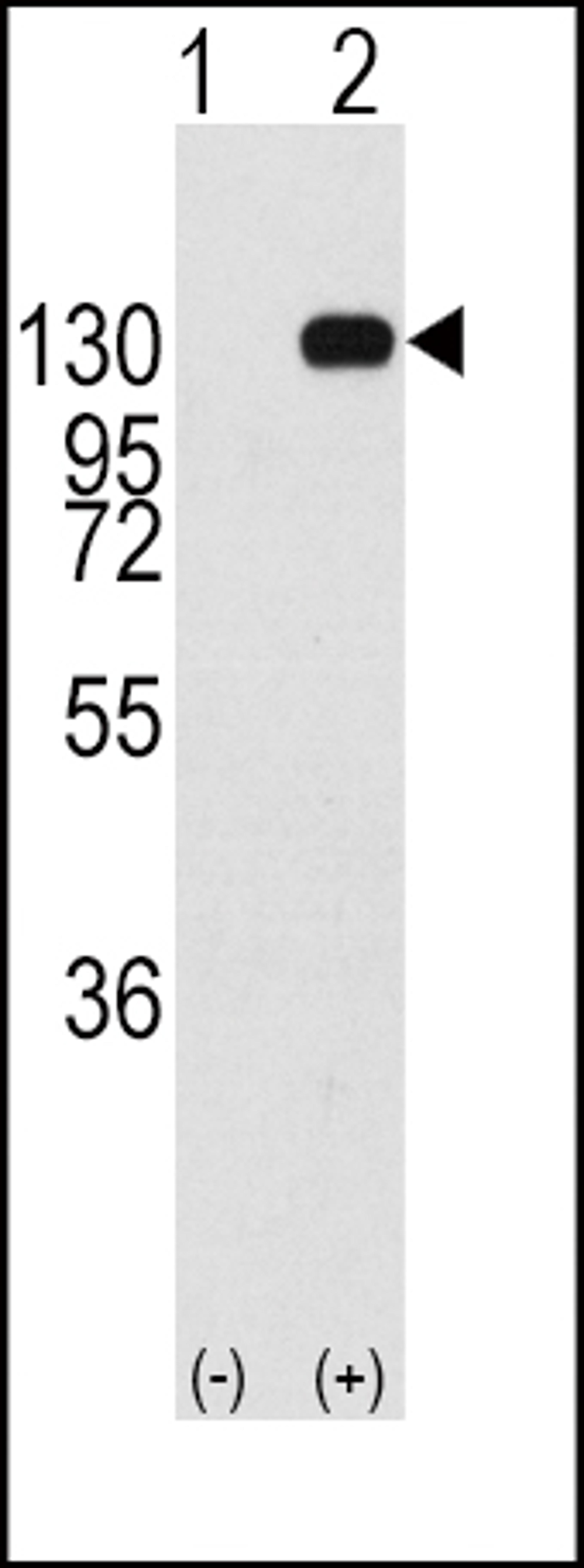 Western blot analysis of FGFR1 using rabbit polyclonal FGFR1 Antibody (Y463) using 293 cell lysates (2 ug/lane) either nontransfected (Lane 1) or transiently transfected with the FGFR1 gene (Lane 2).