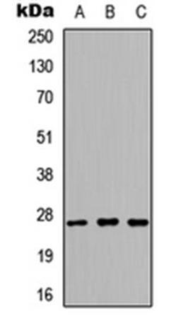 Western blot analysis of HEK293T (Lane1), NS-1 (Lane2), PC12 (Lane3) whole cell using Kallikrein 6 antibody