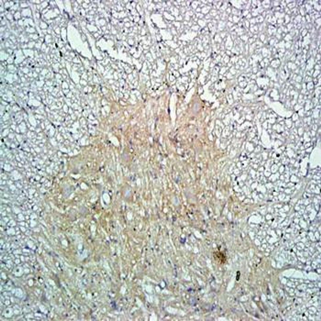 Immunohistochemical analysis of formalin-fixed and paraffin embedded rat spinal cord tissue (Dilution at:1:300) using Oligodendrocyte Marker antibody