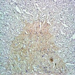 Immunohistochemical analysis of formalin-fixed and paraffin embedded rat spinal cord tissue (Dilution at:1:300) using Oligodendrocyte Marker antibody