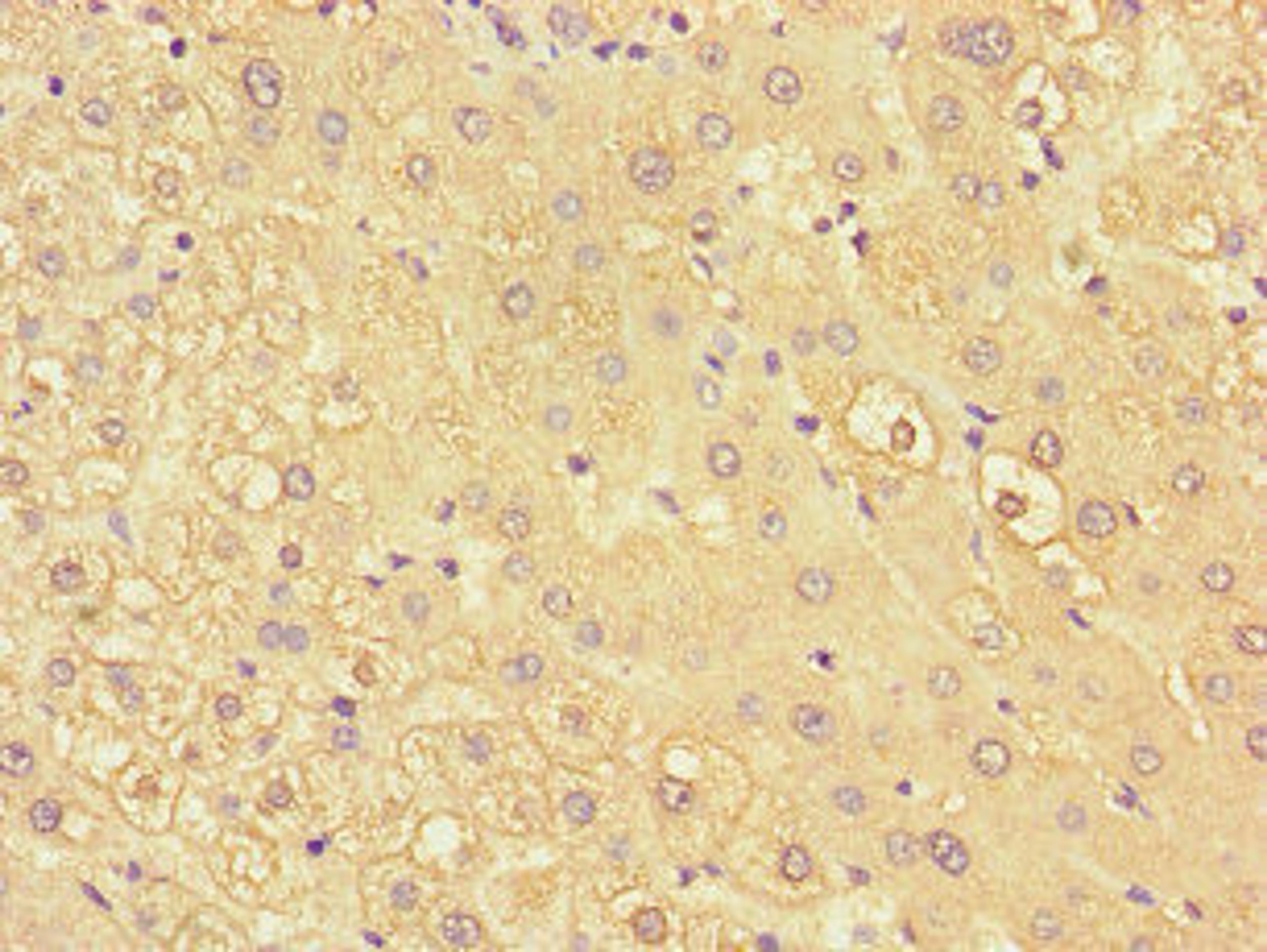 Immunohistochemistry of paraffin-embedded human liver tissue using CSB-PA012354LA01HU at dilution of 1:100