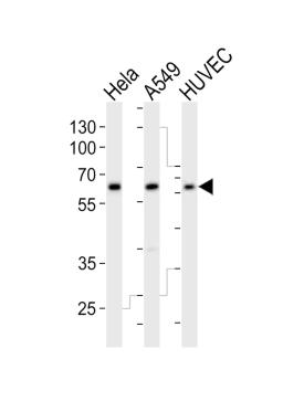 Western blot analysis of lysates from Hela, A549, HUVEC cell line (from left to right), using ESRRG Antibody at 1:1000 at each lane.