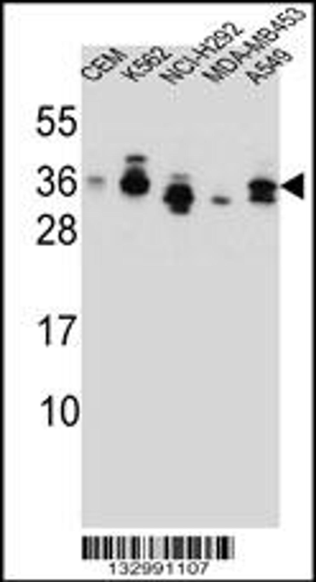 Western blot analysis in CEM,K562,NCI-H292,MDA-MB453,A549 cell line lysates (35ug/lane).