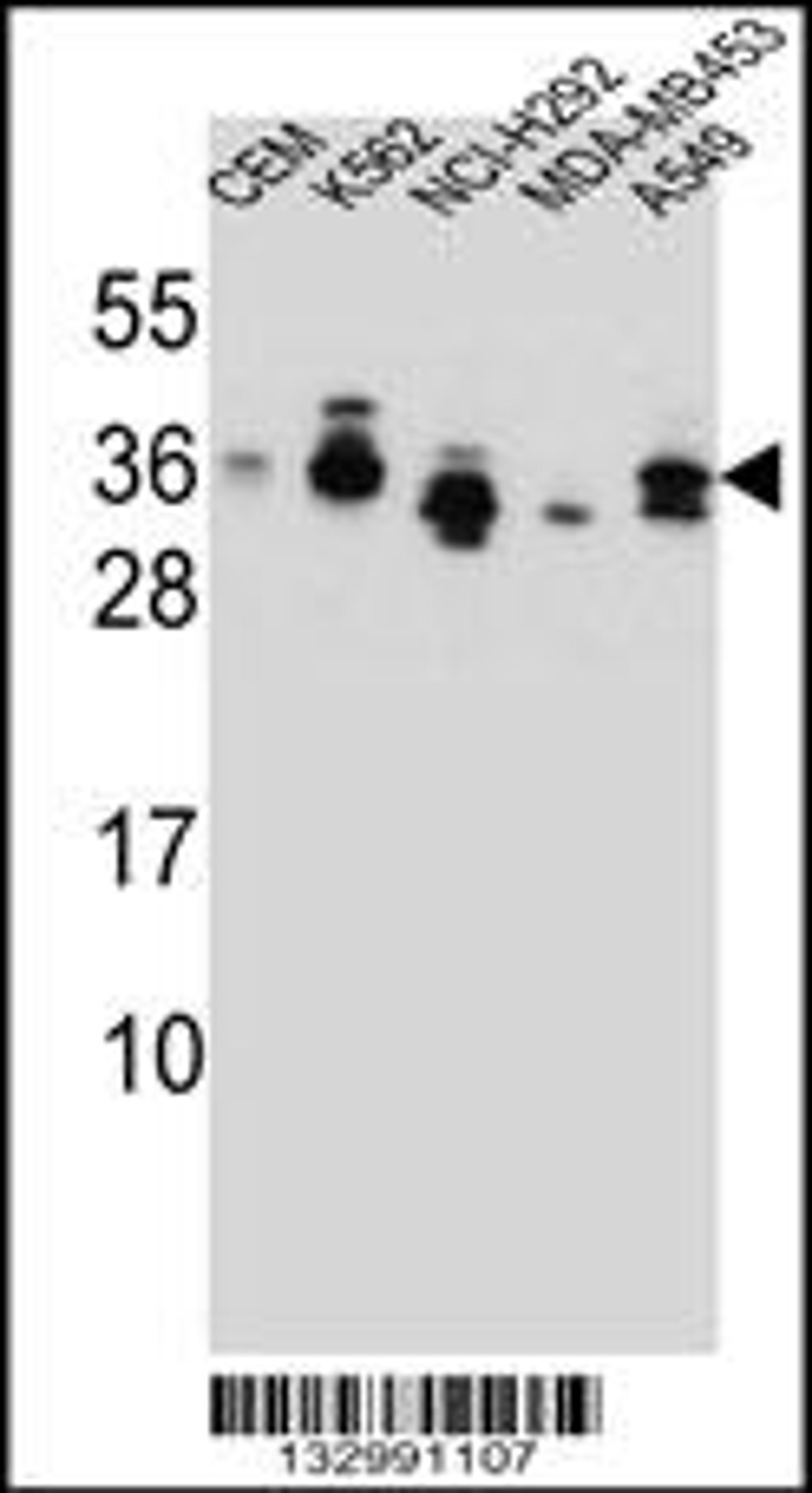 Western blot analysis in CEM,K562,NCI-H292,MDA-MB453,A549 cell line lysates (35ug/lane).