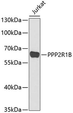 Western blot - PPP2R1B antibody (A6703)