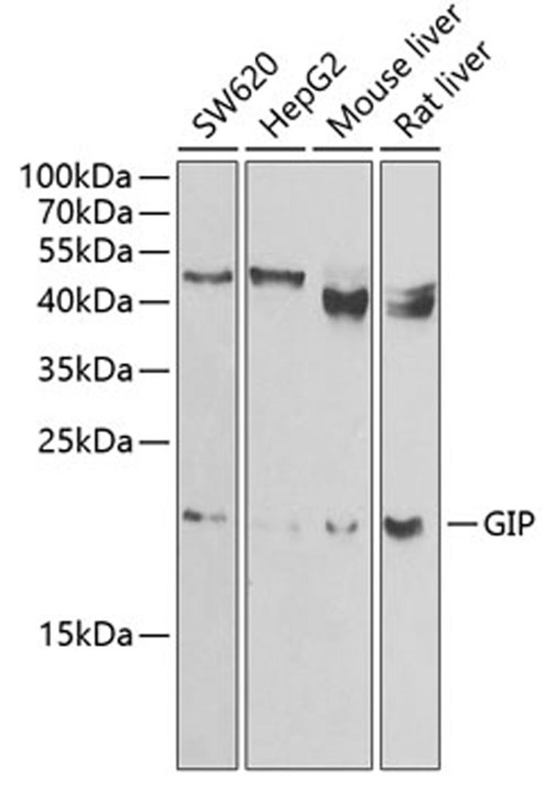 Western blot - GIP antibody (A6230)