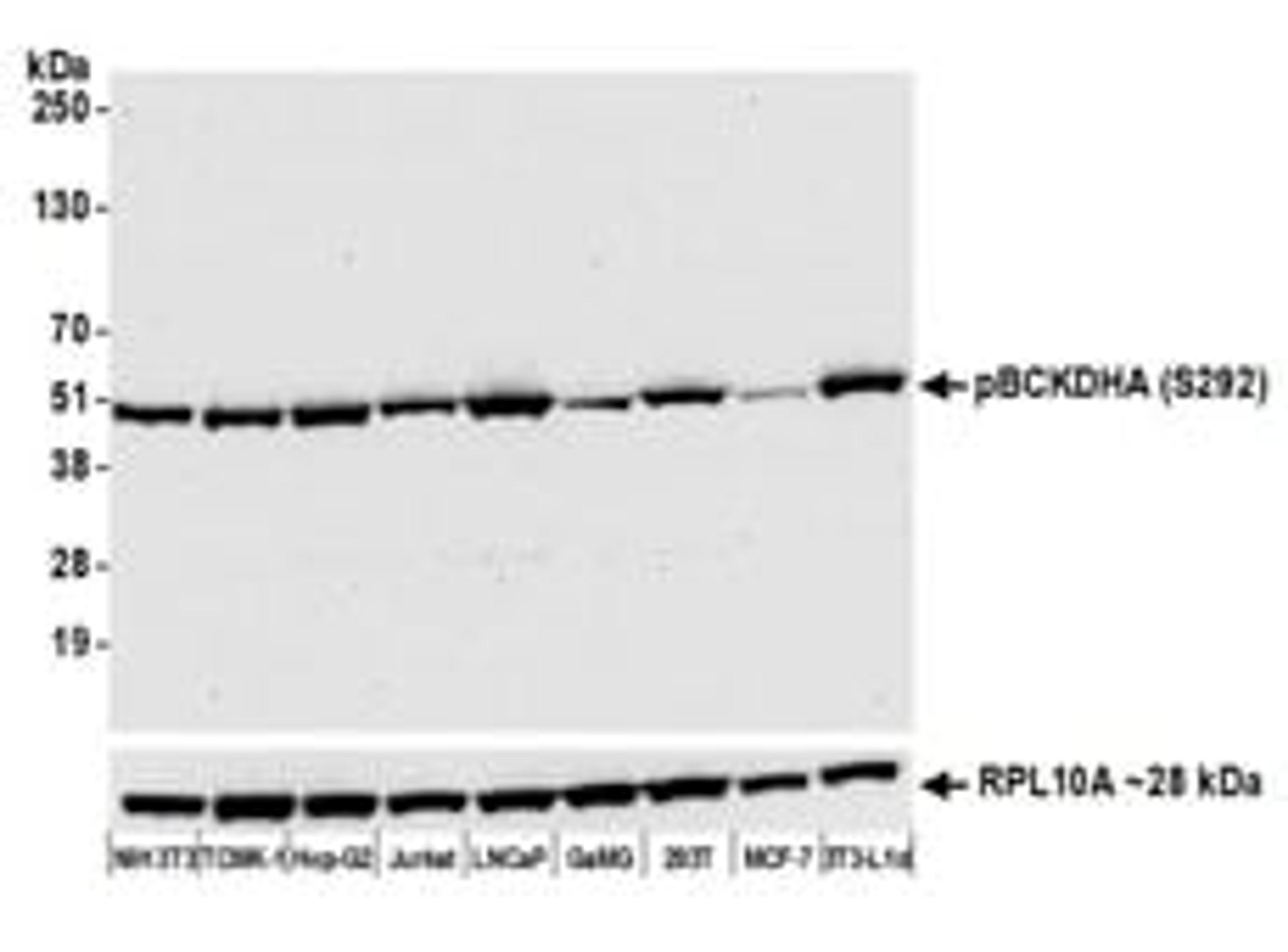 Detection of human and mouse Phospho BCKDHA (S292) by western blot.