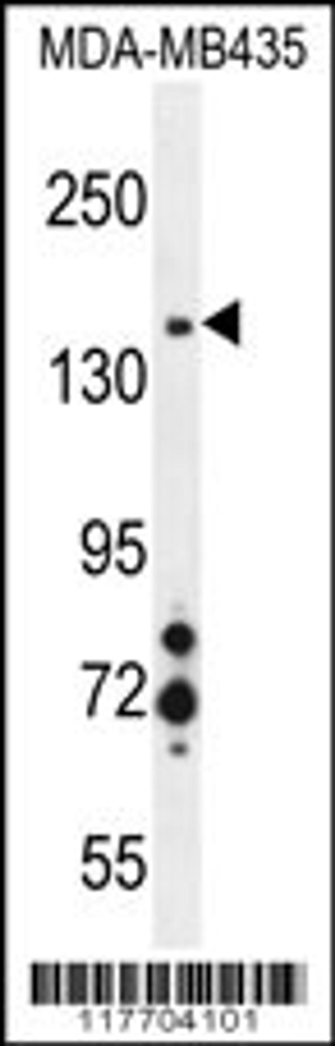 Western blot analysis in MDA-MB435 cell line lysates (35ug/lane).