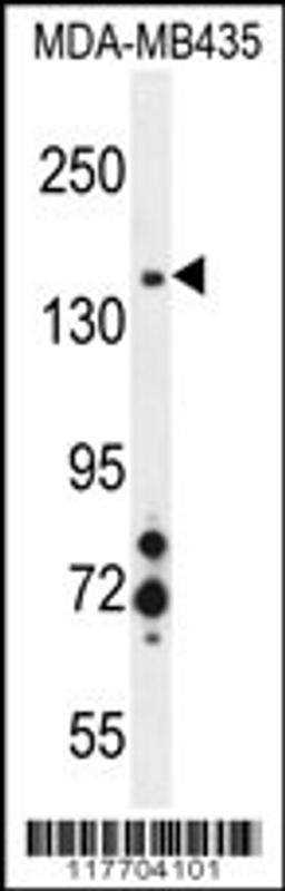 Western blot analysis in MDA-MB435 cell line lysates (35ug/lane).